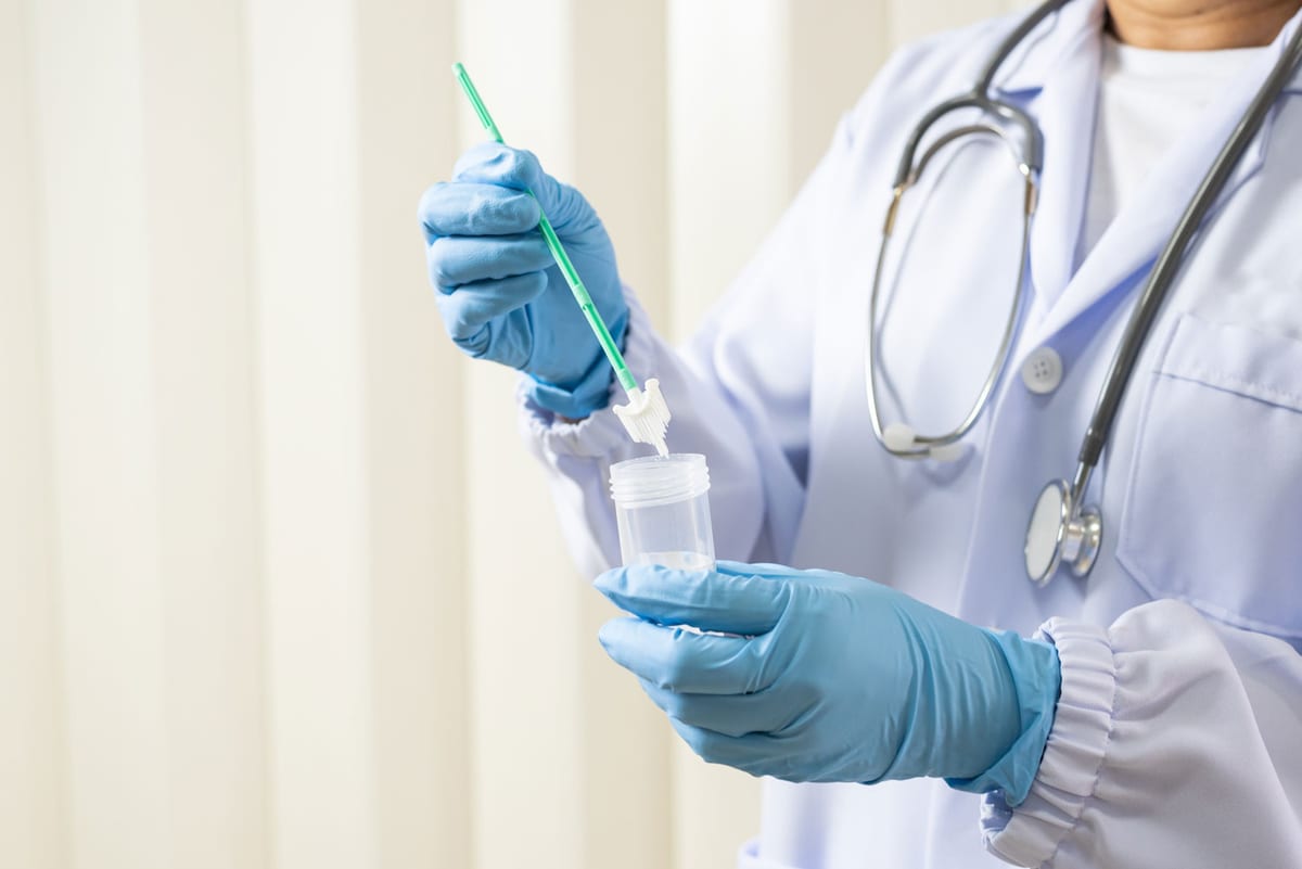 HPV test