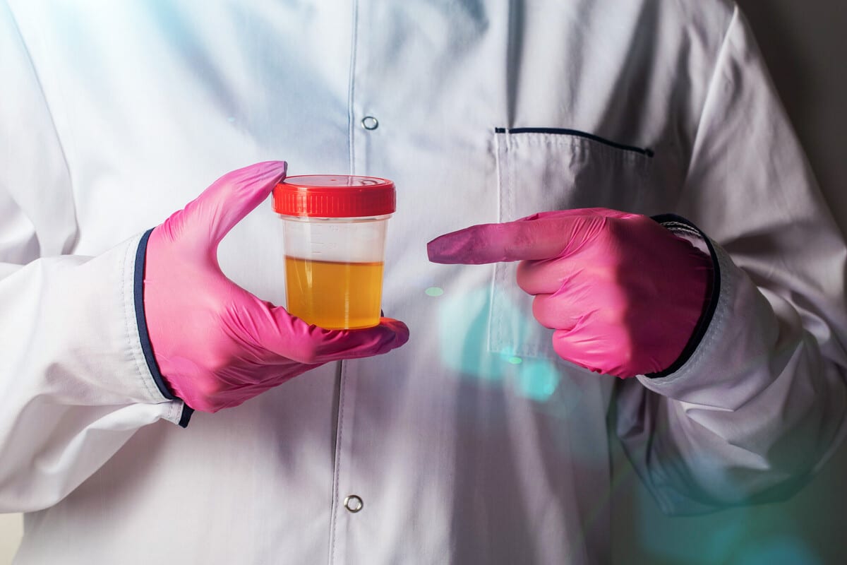 Check up microbiologico · Apparato genito-urinario