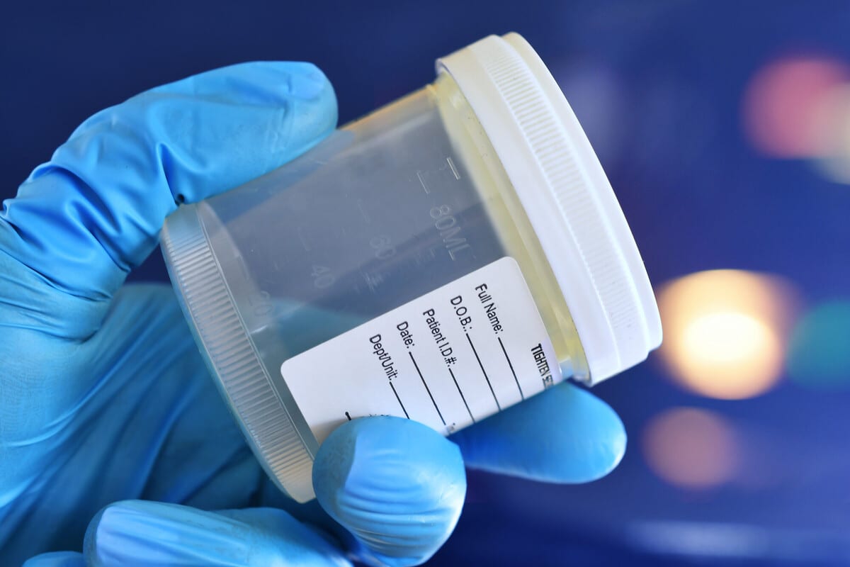Infezioni sessualmente trasmissibili uomo/donna